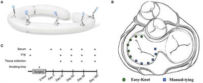 Safety and Effectiveness Outcomes of a Novel Automated Titanium Suture Fastener Device Applied for Heart Valve Surgery in an Ovine Model